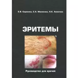 Эритемы. Руководство для врачей