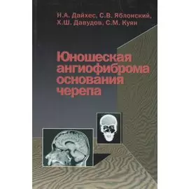 Юношеская ангиофиброма основания черепа