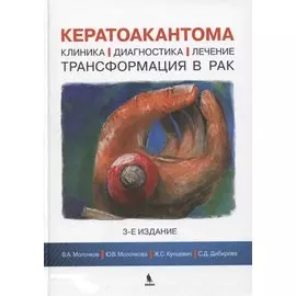 Кератоакантома. Клиника, диагностика, лечение, трансформация в рак. 3-е издание