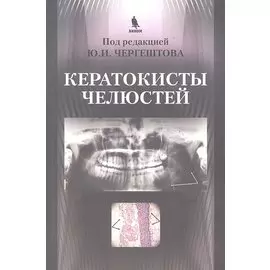 Кератокисты челюстей.