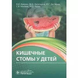 Кишечные стомы у детей