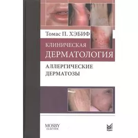 Клиническая дерматология. Аллергические дерматозы.