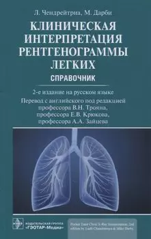 Клиническая интерпретация рентгенограммы легких: справочник