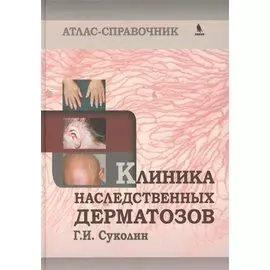Клиника наследственных дерматозов. Атлас-справочник