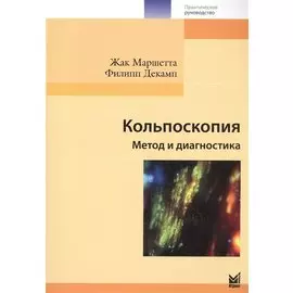 Кольпоскопия