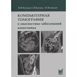 Компьютерная томография в диагностике заболеваний кишечника