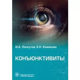 Конъюнктивиты