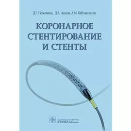 Коронарное стентирование и стенты