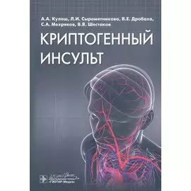 Криптогенный инсульт. Руководство