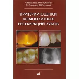 Критерии оценки композитных реставраций зубов
