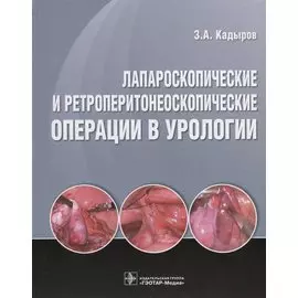 Лапароскопические и ретроперитонеоскопические операции в урологии