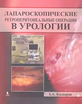 Лапароскопические ретроперитонеальные операции в урологии