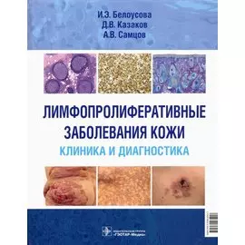 Лимфопролиферативные заболевания кожи. Клиника и диагностика