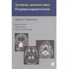 Лучевая диагностика. Оториноларингология