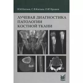 Лучевая диагностика патологии костной ткани