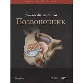 Лучевая диагностика. Позвоночник