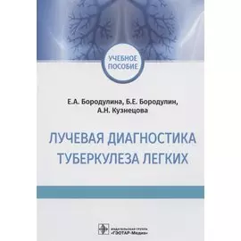 Лучевая диагностика туберкулеза легких. Учебное пособие
