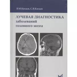 Лучевая диагностика заболеваний головного мозга