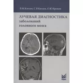 Лучевая диагностика заболеваний головного мозга. 3-е издание