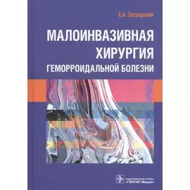 Малоинвазивная хирургия геморроидальной болезни