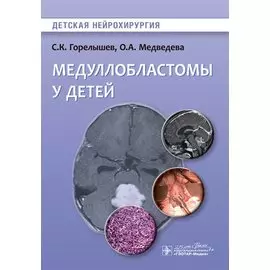 Медуллобластомы у детей