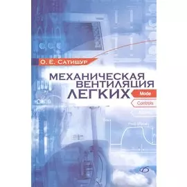 Механическая вентиляция легких