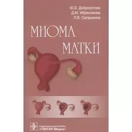 Миома матки