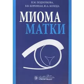 Миома матки
