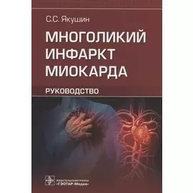 Многоликий инфаркт миокарда: руководство