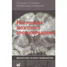Нарушения мозгового кровообращения. Диагностика, лечение, профилактика
