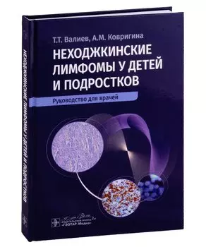 Неходжкинские лимфомы у детей и подростков: руководство для врачей