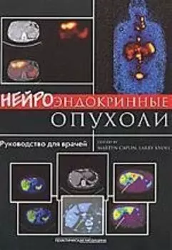 Нейроэндокринные опухоли: руководство для врачей: [пер. с англ.]