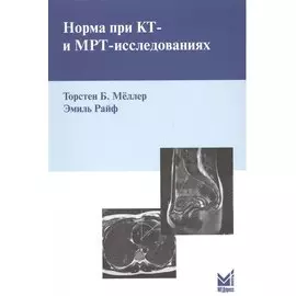 Норма при КТ- и МРТ-исследованиях