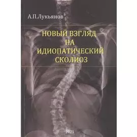 Новый взгляд на идиопатический сколиоз
