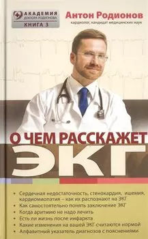О чем расскажет ЭКГ