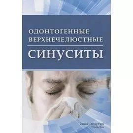 Одонтогенные верхнечелюстные синуситы