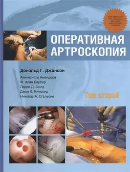 Оперативная артроскопия. Том второй
