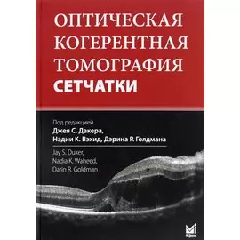 Оптическая когерентная томография сетчатки