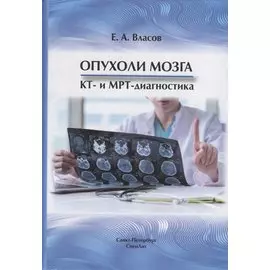 Опухоли мозга КТ- и МРТ- диагностика