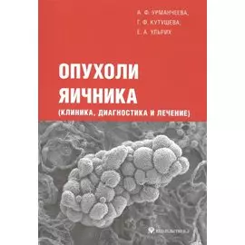 Опухоли яичника (клиника, диагностика и лечение)