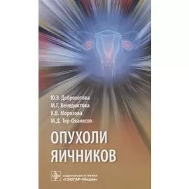 Опухоли яичников