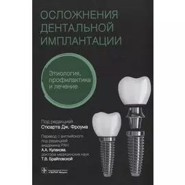 Осложнения дентальной имплантации. Этиология, профилактика и лечение