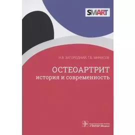 Остеоартрит: история и современность