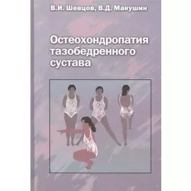 Остеохондропатия тазобедренного сустава. Руководство для врачей