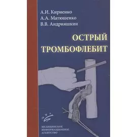 Острый тромбофлебит