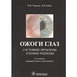 Ожоги глаз. Состояние проблемы и новые подходы