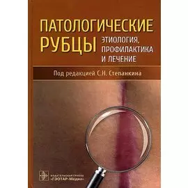Патологические рубцы. Этиология, профилактика и лечение