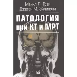 Патология при КТ и МРТ