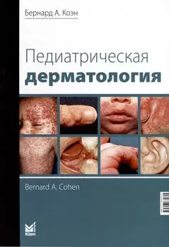 Педиатрическая дерматология