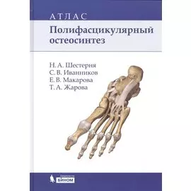Полифасцикулярный остеосинтез: атлас